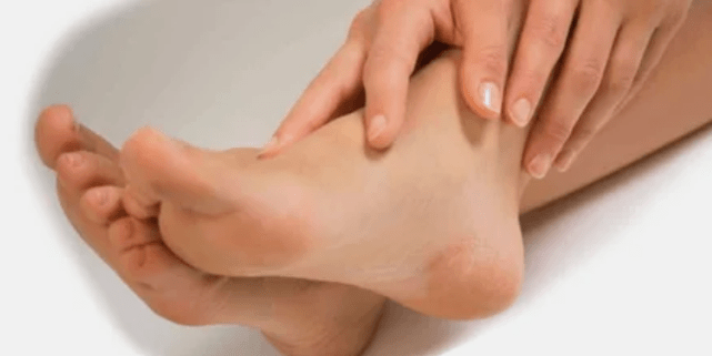 Iltze onddoaren tratamendua